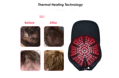 Biomol - Red Light Therapy Cap for Hair Growth with Smart Controller